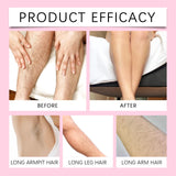 Painless Hair Removal Spray – Body & Underarm Hair Inhibitor | بخاخ إزالة الشعر بدون ألم – تثبيط نمو الشعر للجسم وتحت الإبط